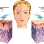 HOW TO REBUILD COLLAGEN IN THE FACE