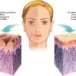 HOW TO REBUILD COLLAGEN IN THE FACE