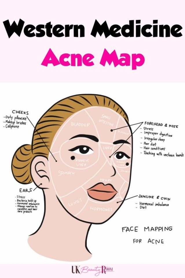 Acne Face Map What Your Acne is Telling You About Your Health