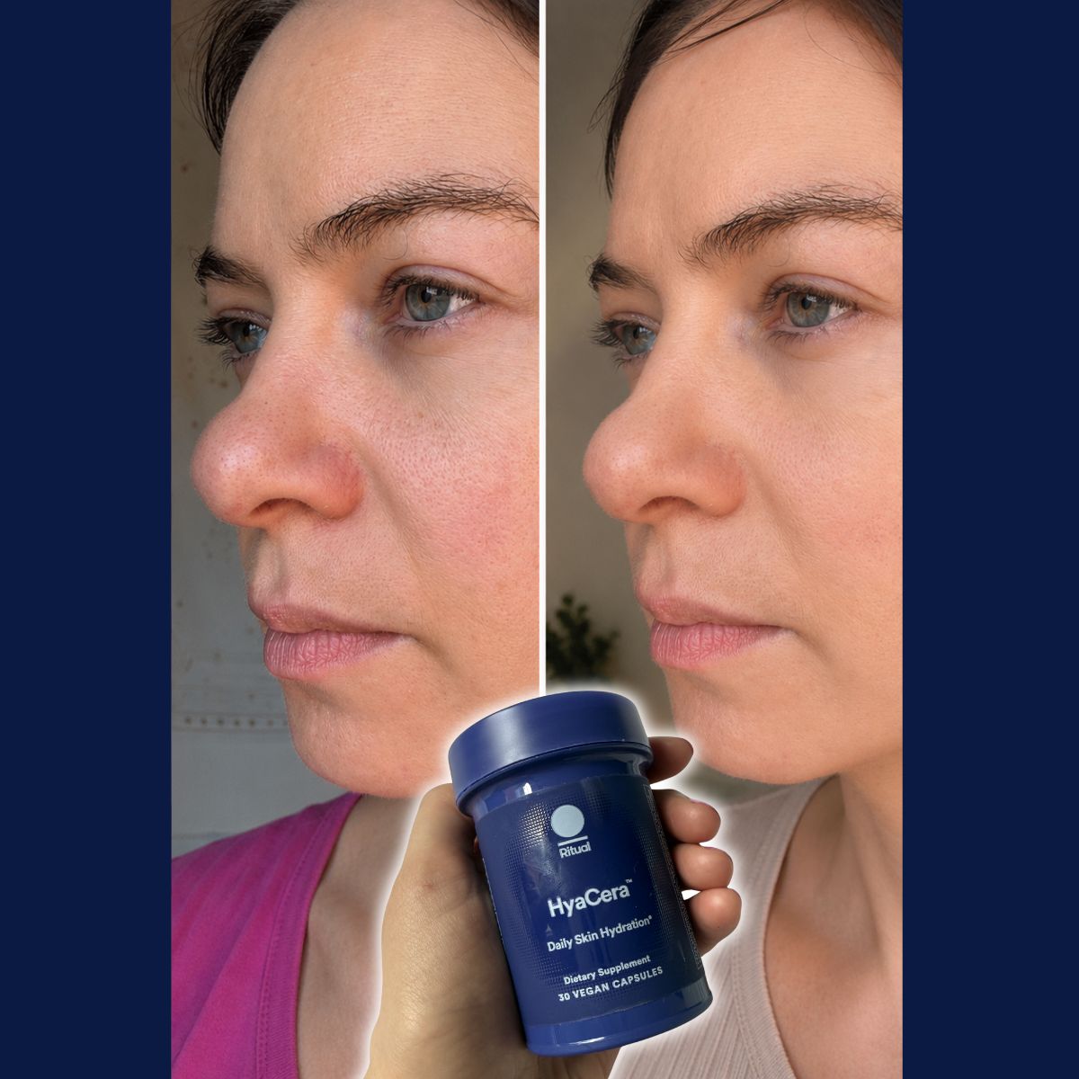 Ritual Hyacera before and after